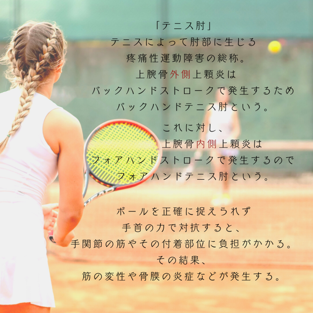 肘の痛み、肘の障害、テニス肘、野球肘、ゴルフ肘、上腕骨外側上顆炎、上腕骨内側上顆炎、鎮痛剤、シップ、オステオパシー、沖縄南城市整体院、女性理学療法士、体の不調、姿勢、病気の改善、痛みの原因、根本的な原因、自然治癒力、恒常性