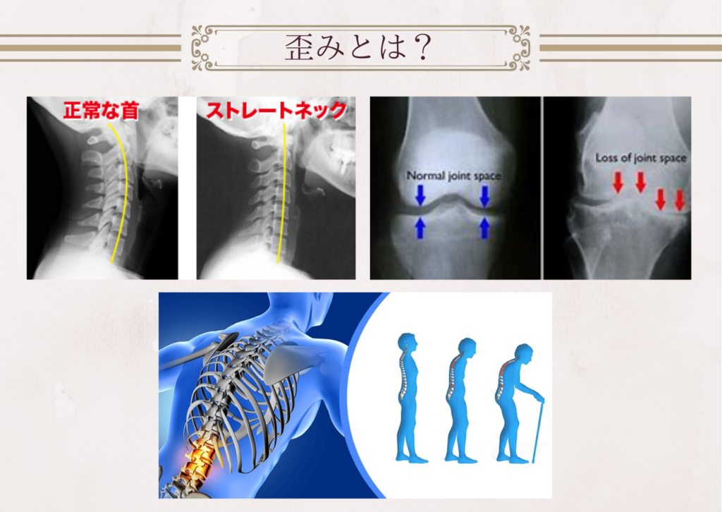 オステオパシー、歪み、痛み、不調